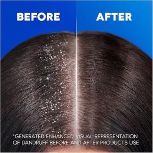 Head & Shoulders Apple Fresh Anti Dandruff Shampoo, 1000ml