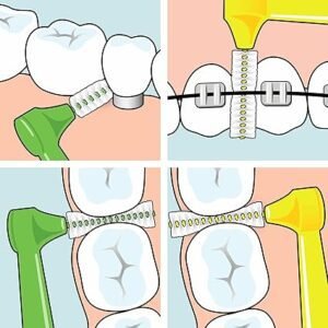 TePe Interdental Brush Angle, Mixed Pack, 0.4-0.8mm/ISO 1-6, 6pcs,